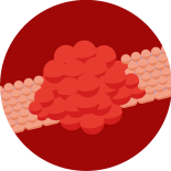 Icoon kankercel 2