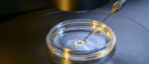 In-vitrofertilisatiemiscrosoop