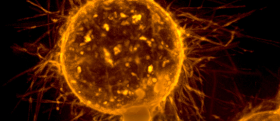 Borstkankercel, metastase, microtentakels